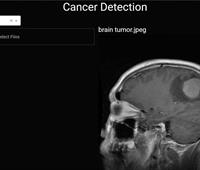 Cancer Detection in skin and brain