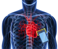 Heart murmur detection using AI