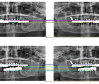 Fraud Detection _ X-Ray